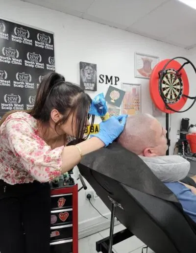 Scalp micropigmentation treatment in progress